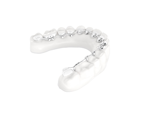 Kieferorthopäden Münchner Freiheit, WIN-Zahnspange 