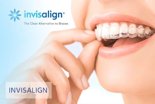 Invisalign Kieferorthopädie München Dr. Schmidmer 